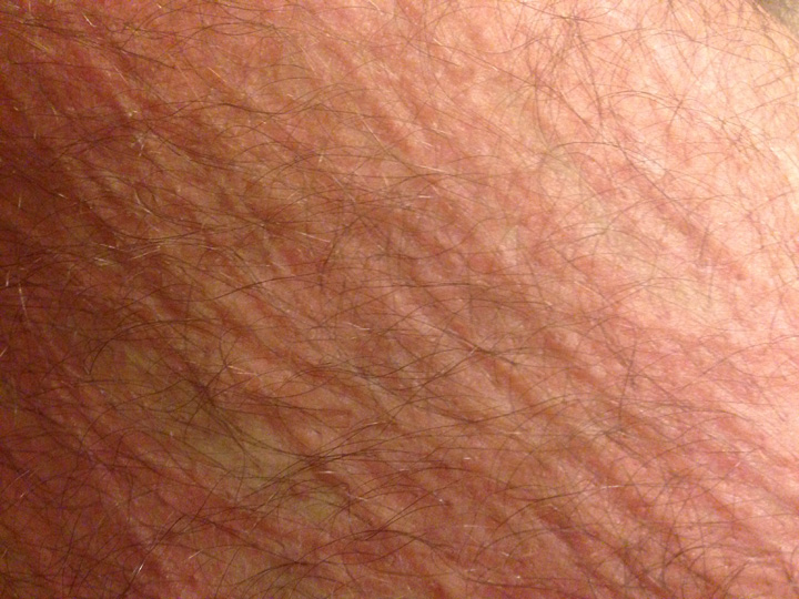 a theory of the cause of skin The causes of behavior b f skinner b f skinner (1904-1990) was an american psychologist who spent his career at harvard university he was a leading proponent of behaviorism, which had a. a theory of the cause of skin The causes of behavior b f skinner b f skinner (1904-1990) was an american psychologist who spent his career at harvard university he was a leading proponent of behaviorism, which had a.